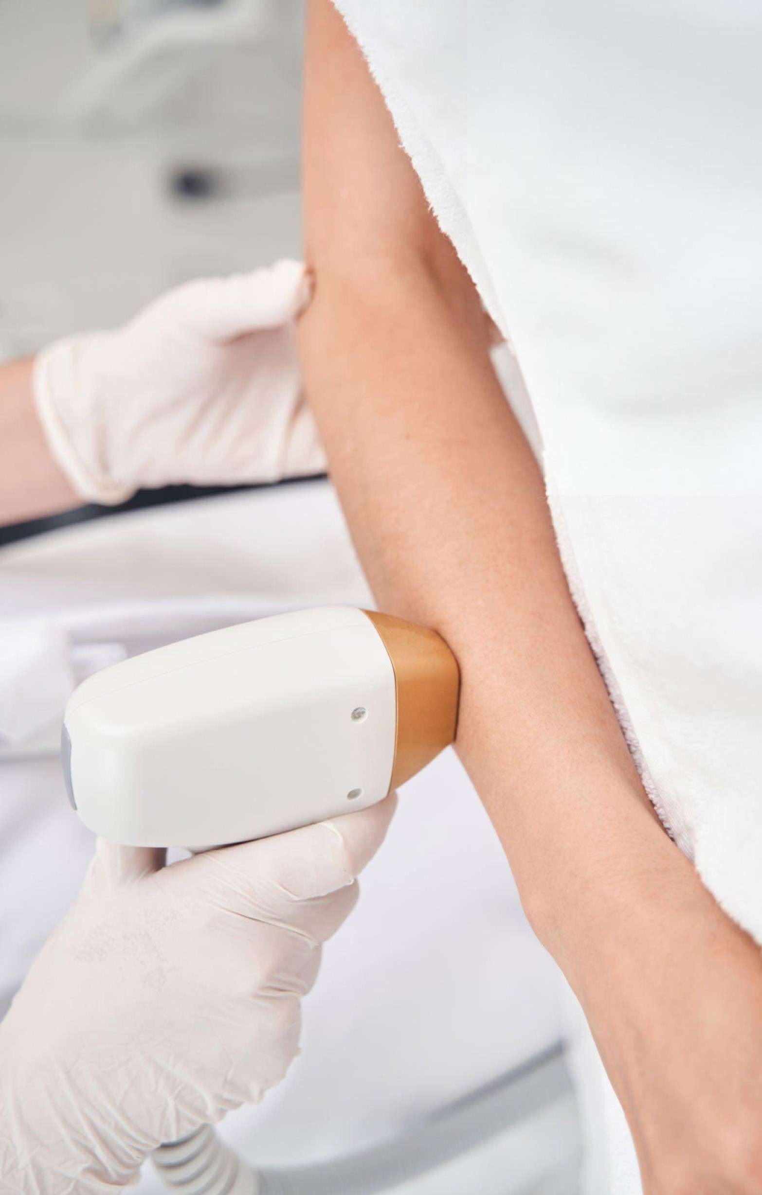 Quad Laser Hair Removal